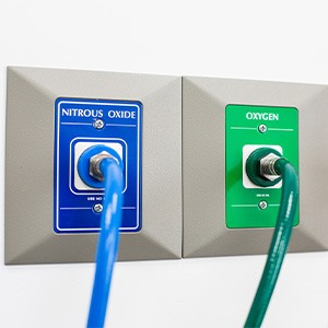 Outlets labeled 'nitrous oxide' and 'oxygen'